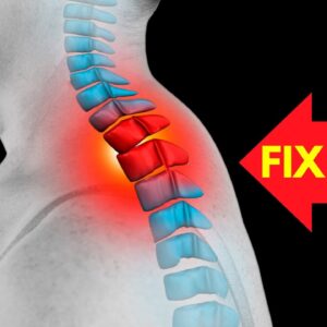 How to Fix a Neck Hump at Home