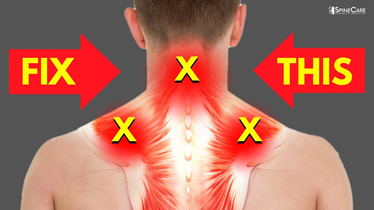 How To Fix A Sore Neck And Shoulders In SECONDS