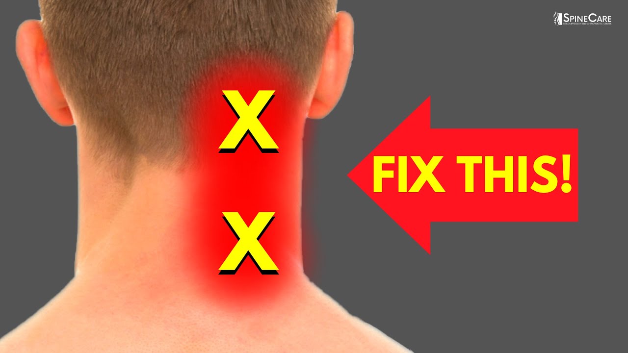 how-to-fix-neck-pain-off-to-the-side