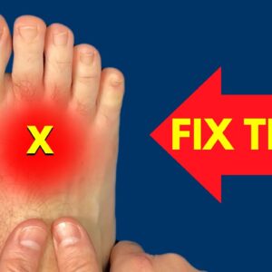 How to Fix Pain on the TOP of the Foot