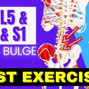 L4 L5 & L5 S1 Disc Bulge, Best Exercises Rehab For Relief