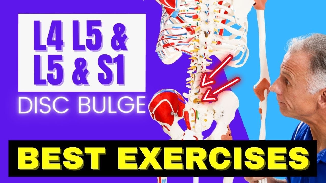 L4 L5 And L5 S1 Disc Bulge Best Exercises Rehab For Relief 3027