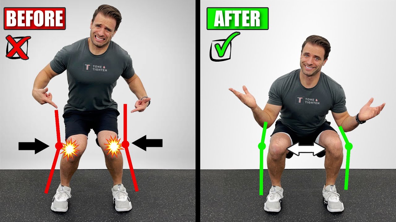 How To Fix Knock Knees Exercises To Correct Knee Valgus