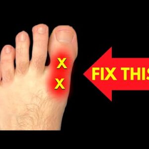 How to Fix BIG TOE Pain for Good